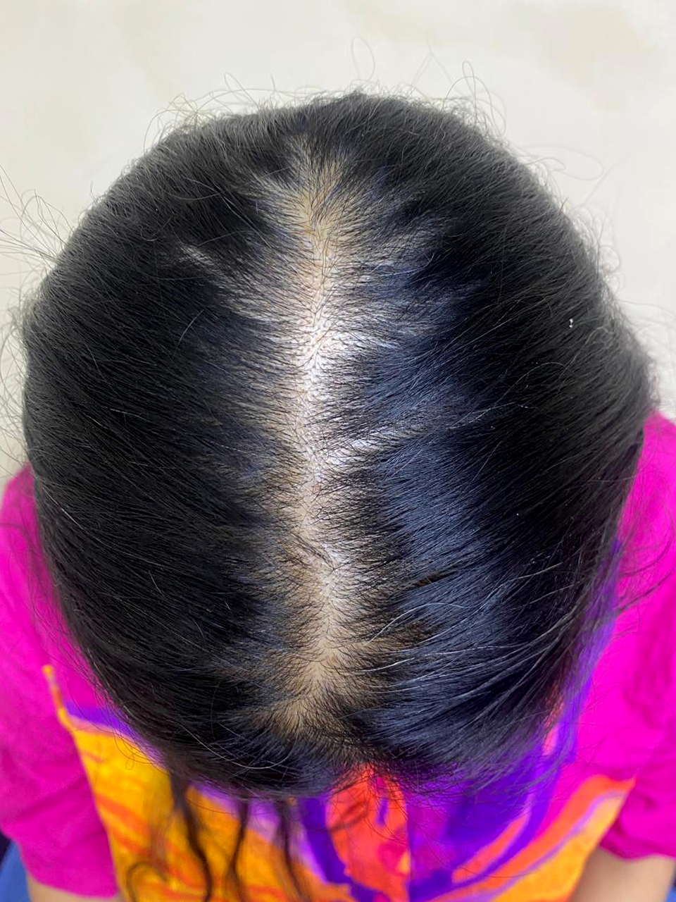 After treatment